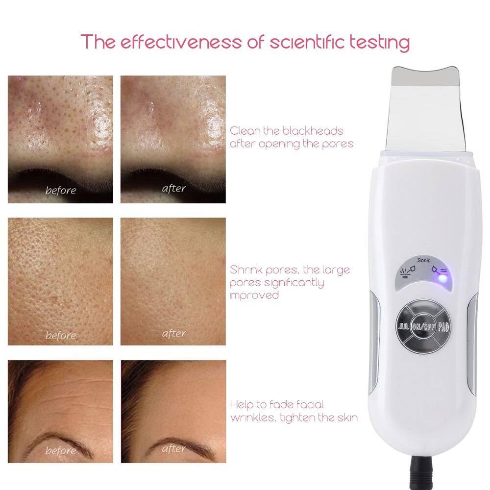 Home Use Ultrasonic Skin Scrubber Face Cleaner