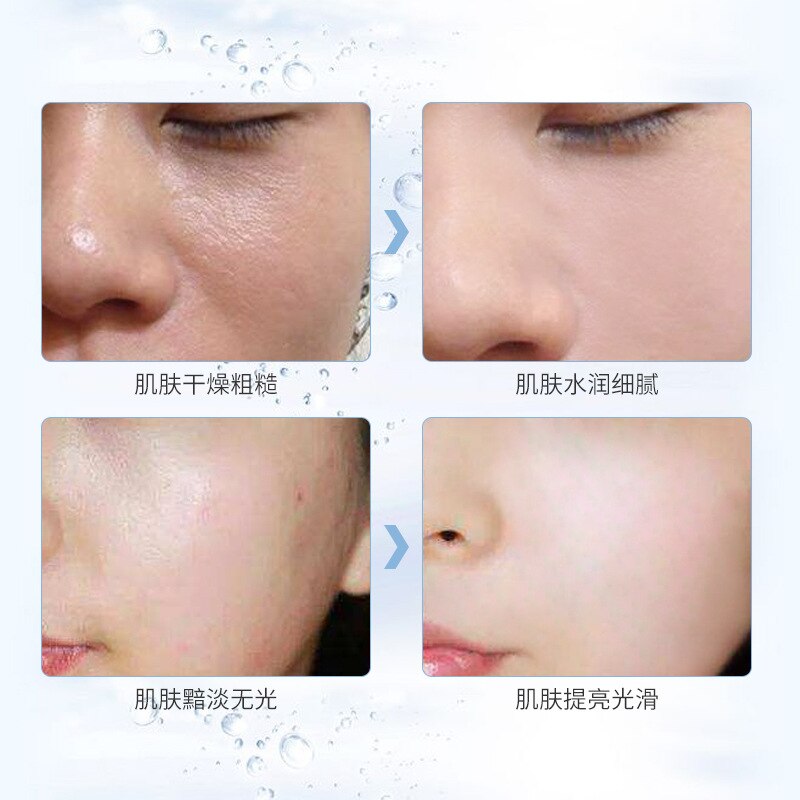 Skin Management Product Small Molecule Medical Beauty Hyaluronic Acid